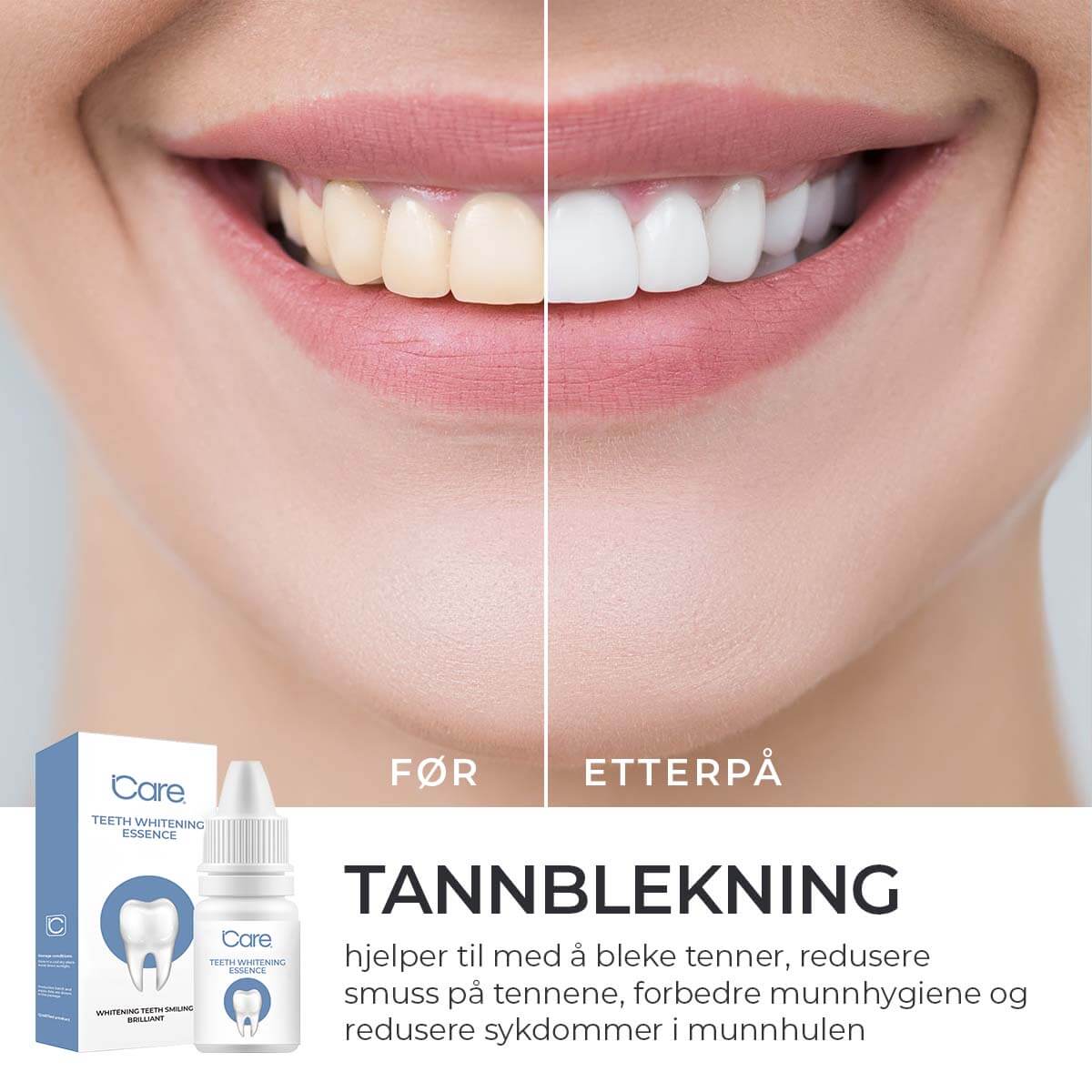 (40% RABATT) formel for tannblekingsskum